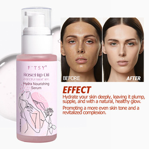 Aceites <span class=keywords><strong>de</strong></span> masaje facial <span class=keywords><strong>de</strong></span> <span class=keywords><strong>rosa</strong></span> <span class=keywords><strong>mosqueta</strong></span> orgánicos OEM Producto <span class=keywords><strong>para</strong></span> el cuidado <span class=keywords><strong>de</strong></span> <span class=keywords><strong>la</strong></span> piel <span class=keywords><strong>para</strong></span> rejuvenecer Arrugas <span class=keywords><strong>de</strong></span> reparación - Product Image 4