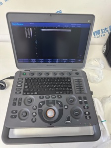 Échographe portable Sonoscape X3, échographe Doppler couleur pour usage humain, imagerie haute définition pour les urgences et le diagnostic - Product Image 4