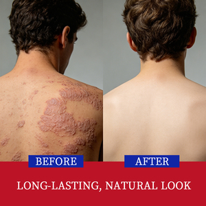 Crema de Alta Calidad para el Cuidado de la Piel Sensible con Problemas de Dermatitis, Psoriasis y Eccema, Nutritiva y Calmante - Product Image 2