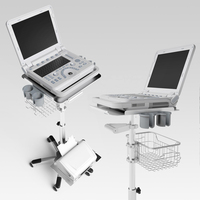 CONTEC — Scanner médical à ultrasons Portable, sans fil, médical 3d