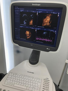 Sonoscape S12 Máquina de Ultrasonido Portátil, Ecógrafo - Product Image 5