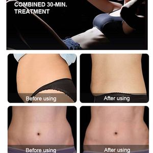 Máquina Profesional 2026 de 4 Manijas EMS RF <span class=keywords><strong>para</strong></span> Esculpir Músculos, Reducir Grasa y Adelgazar el Cuerpo - Product Image 6