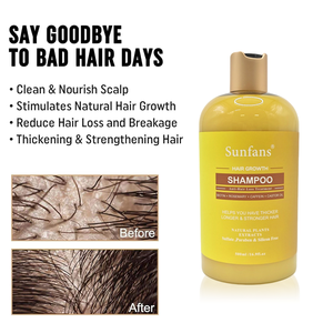 Shampoo fortifiant aux racines organiques, huile d'arbre à thé, huile de <span class=keywords><strong>ricin</strong></span>, anti-chute de cheveux, nourrissant, hydratant pour cheveux secs, biotine, huile d'argan - Product Image 1