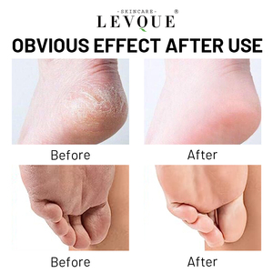 Exfoliante en Polvo para Pies Jelly <span class=keywords><strong>Spa</strong></span>, Eliminador de Callosidades y Piel Muerta, Cuidado para Talones Secos y Agrietados, Exfoliante para Pies OEM - Product Image 4
