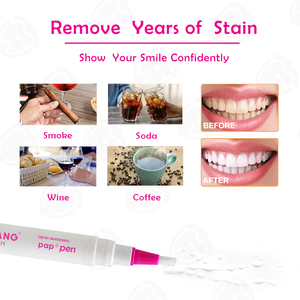 Penna Sbiancante per Denti di Alta Qualità, Gel per Igiene Orale e Sbiancamento Dentale PAP - Product Image 3