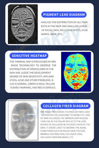 Ce formazione online ai analizzatore di diagnostica della pelle del viso Tester del viso scanner specchio magico della pelle analisi della macchina analizzatore della pelle - Product Image 6