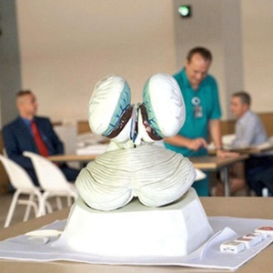 Modello Anatomico dell'Organo del Corpo Umano del Quarto Ventrice con Tessuto Coroidale e Plexo Coroidale per Formazione Medica - Product Image 6