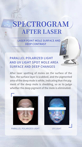 Analizador de Piel de Alta Calidad con Lente de Microscopio UV para Diagnóstico de Acné, Analizador de Piel Profesional para Pruebas Faciales - Product Image 5