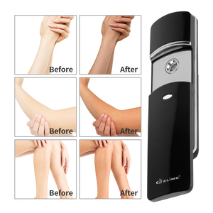 Vente en gros bon marché Vapeur pour le visage Vapeur pour le visage Conception écologique Nano Mist Pulvérisateur Hydratation Vaporisateur pour le visage - Product Image 5