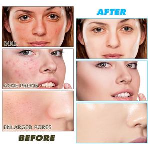 Almohadillas Limpiadoras Faciales de Ácido Kójico y Cúrcuma, 60 Unidades, Venta al por Mayor de Fábrica, Aptas para Todo Tipo de Piel - Product Image 6