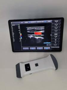 プロ仕様のワイヤレス凸プローブとリニアアレイプローブ2 in 1カラードップラー超音波プローブ - Product Image 3