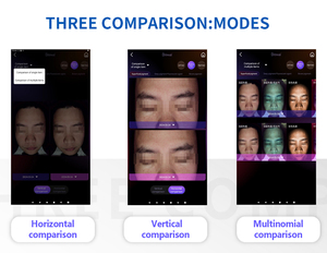 Appareil d'analyse de la peau, analyseur de peau du visage, analyseur de peau 3D pour salon de beauté - Product Image 6