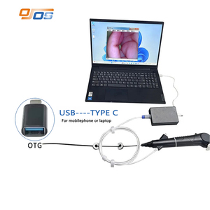Cistoscópio Endoscópio Flexível Reutilizável de Alta Qualidade de 380mm, Instrumentos Cirúrgicos USB para Uso Veterinário em Cães - Product Image 1
