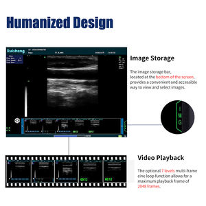 휴대용 초음파 기계 하이 엔드 <span class=keywords><strong>PC</strong></span> 기반 노트북 BW 초음파 스캐너 병원 장비 인간을위한 초음파 기계 - Product Image 6