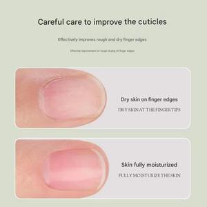Aceite Nutritivo para Cutículas, Cuidado de las Uñas, Anti-Barras, Suavizante, Hidratante, Barra Nutritiva para la Piel con Fragancia de Rosa y Fresia - Product Image 2