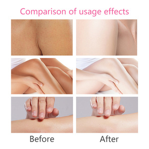 Vente en gros d'usine de crème éclaircissante à la niacinamide <span class=keywords><strong>sur</strong></span> mesure pour hydrater et nourrir le visage et le corps - Product Image 5