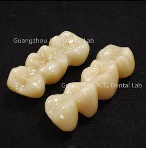 Prothèses dentaires en <span class=keywords><strong>zircone</strong></span> toutes les couronnes et ponts en céramique de haute qualité, bonne biocompatibilité et prix abordable - Product Image 5