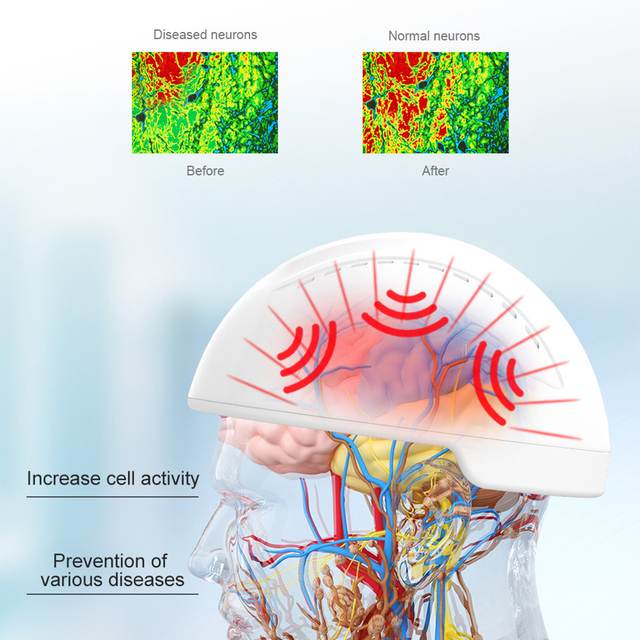 Sleeping Disorder Improvement 810nm Brain Neuron Stimulation Device Infrared LED Therapy Helmet for Cognitive Decline