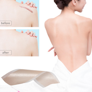 Parche de gel de silicona para cicatrices de 0.25 mm de grosor, reutilizable para mejorar las cicatrices postoperatorias y cuidado de la atenuación de las marcas. - Product Image 1