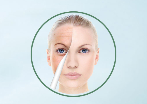 Кожа забеливая чистые 99% Snowwhite чистые выдержки завода 1