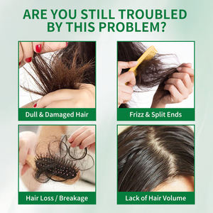 เซรั่มปลูก<span class=keywords><strong>ผม</strong></span>สูตรธรรมชาติ W3W สำหรับขายส่งแบบ Private Label บรรจุภัณฑ์แบบลูกกลิ้งสามลูก - Product Image 5