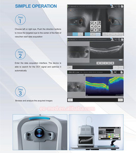 Tomografía de Coherencia Ó<span class=keywords><strong>ptica</strong></span> OCT-50, Máquina OCT Totalmente Automática, Precio de Fábrica - Product Image 5