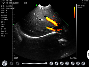 Konted Mdr Draagbare Microconvexe Ultrasone Draadloze Sonde Voor Kleine Organen En Hart - Product Image 5