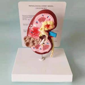 Modèle d'enseignement médical Modèle de rein pathologique <span class=keywords><strong>canin</strong></span> pour l'éducation vétérinaire et la démonstration de la maladie rénale - Product Image 4