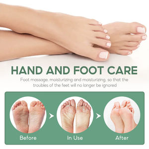 Venta directa de fábrica Etiqueta privada <span class=keywords><strong>40</strong></span>% <span class=keywords><strong>Urea</strong></span> Cuidado DE LOS PIES Aceite de árbol de té <span class=keywords><strong>Crema</strong></span> para pies Reparación Hidratante Peel Talones agrietados - Product Image 3