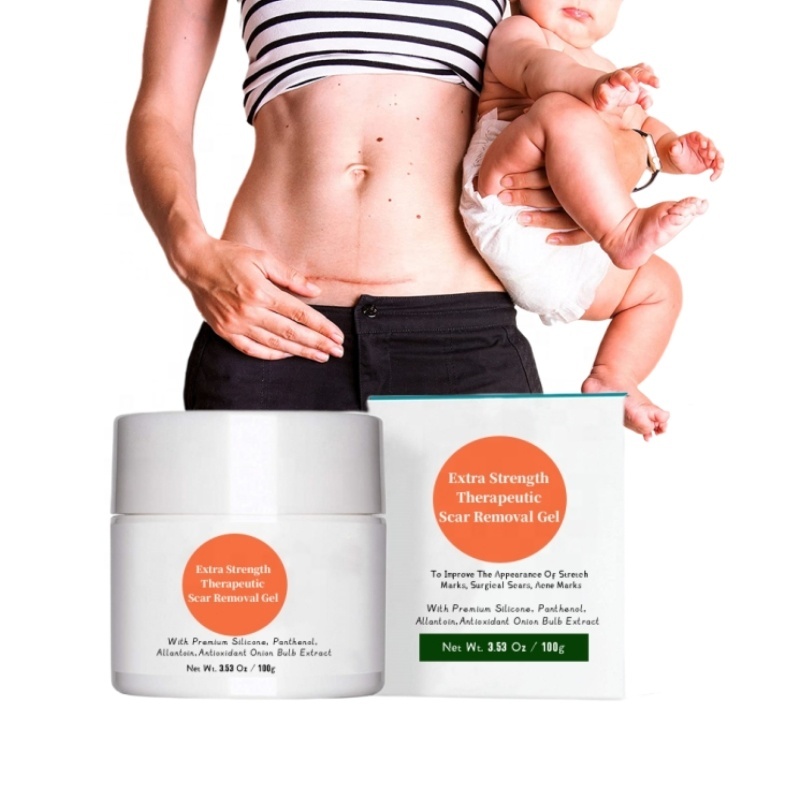 Stretch Mark Cream with Aloe Vtamn