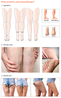 2025 Neueste Technologie Tragbare Kompression stiefel Luft massage Presso therapie gegen Varikosität
