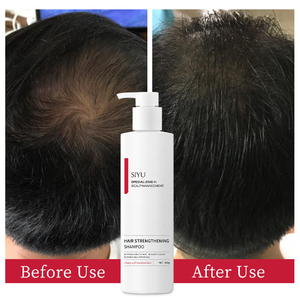 Champú Fortalecedor del Cabello Ecológico para Mayor Volumen y Nutrición Profunda del Cuero Cabelludo, Venta al Por Mayor - Product Image 5