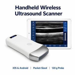 Échographe portable sans fil pour iOS <span class=keywords><strong>et</strong></span> Android, sonde d'échographie <span class=keywords><strong>Doppler</strong></span> couleur de poche pour l'échographie abdominale <span class=keywords><strong>et</strong></span> obstétricale - Product Image 1