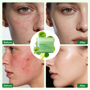 Pads de coton pour soins de la peau à la Centella Asiatica IREV, marque privée, apaisent les rougeurs et les gonflements, nettoyage en profondeur, boîte OEM. - Product Image 5