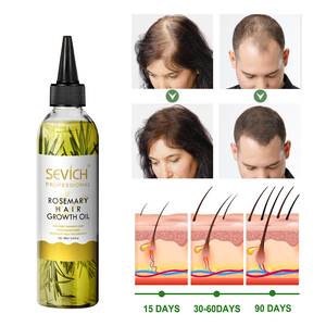 Riparare il cuoio capelluto crespo danneggiato cura dei capelli trattamento Anti-perdita crescita rapida siero all'olio di crescita dei capelli al rosmarino - Product Image 3
