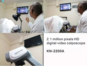 Kernel KN 2200A Grossissement 216x, 2,1 mégapixels au total, imagerie HD, microstructures cervicales et changements pathologiques précoces - Product Image 5