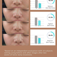 6 1 générateur de petites bulles d'oxygène d'hydrogène pour les salons de beauté H2O2 soins de la peau visage Spa masque facial à hydrogène ménage extérieur
