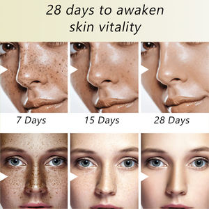 Etiqueta privada Cuidado de la piel facial Belleza Antienvejecimiento Reduce las arrugas Reparación efectiva Se desvanecen Pecas Crema facial para eliminar manchas oscuras - Product Image 5