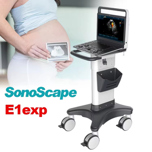 Ecógrafo Doppler Color Portátil Sonoscape E1EXP, Mejor <span class=keywords><strong>Precio</strong></span>, Escáner de Ultrasonido E1 Expert para Obstetricia y Ginecología - Product Image 3
