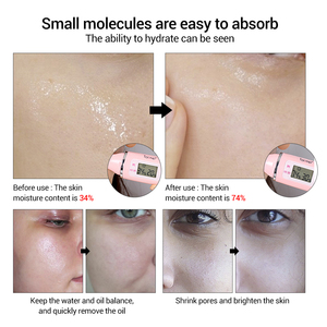 <span class=keywords><strong>LANBENA</strong></span> Ácido Hialurónico Suero Facial Anti-Envejecimiento Retráctil Blanqueamiento de <span class=keywords><strong>Poros</strong></span> Esencia Hidratante - Product Image 5