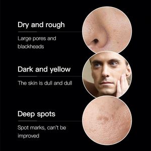 VENZEN Marque Privée Vente en Gros Soins <span class=keywords><strong>de</strong></span> la Peau <span class=keywords><strong>Beauté</strong></span> <span class=keywords><strong>Produits</strong></span> <span class=keywords><strong>de</strong></span> Soin pour Hommes Anti-Acné Exfoliant Naturel Ensemble <span class=keywords><strong>de</strong></span> Soins <span class=keywords><strong>de</strong></span> la Peau Coréen - Product Image 4