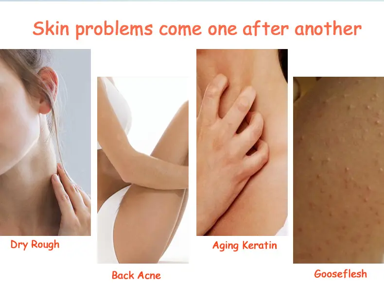 Custom Organic White Body Lotion Remove Spots Body Cream Moisturizing Milk Whitening Body Lotion For Black Skin