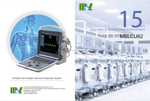 Aplicación clínica Led médica Ecografía Doppler de color portátil B/W Escáner de ultrasonido Máquina de ultrasonido - Product Image 5