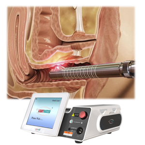 1470 एनएम लेजर विकिरण योनि दीवार योनि कायाकल्प एलवीर गर्भाशय ग्रीवा सूजन मूत्र असंयम का लेजर उपचार - Product Image 1