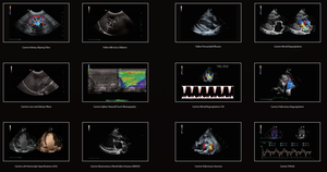 Échographe vétérinaire numérique complet Mindray Vetus 9 à prix bas, vente en gros, pour clinique vétérinaire haut de gamme - Product Image 6
