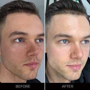 Marque privée OEM Produits de soin de la peau pour hommes Soins personnels pour hommes Nettoyant pour le visage anti-acné Kit de toilettage rafraîchissant pour hommes - Product Image 4