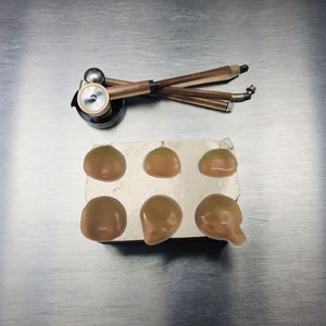 Медицинская анатомическая модель: нормальная и патологическая простата, гиперплазия простаты, патологии простаты - Product Image 2