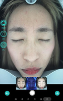 Machine d'analyse intelligente de la peau du visage avec caméra HD 16MP, numérisation rapide en 20 secondes, rapport de comparaison avant-après, exportation PDF