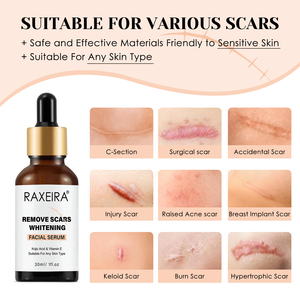 Điều Trị Mụn Trứng Cá Huyết Thanh Tự Nhiên Trên Khuôn Mặt Chất Mụn Loại Bỏ Vết Sẹo Mặt Chăm Sóc Da Làm Trắng Sửa Chữa Mụn nhọt Loại Bỏ 30Ml - Product Image 5