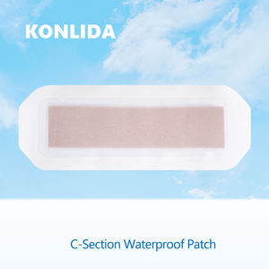 सीजेरियन सेक्शन पोस्टपार्टम उपचार चिकित्सा ग्रेड चिपकने वाला चिकित्सा ग्रेड चिपकने वाला चिकित्सा ग्रेड चिपकने वाला - Product Image 4